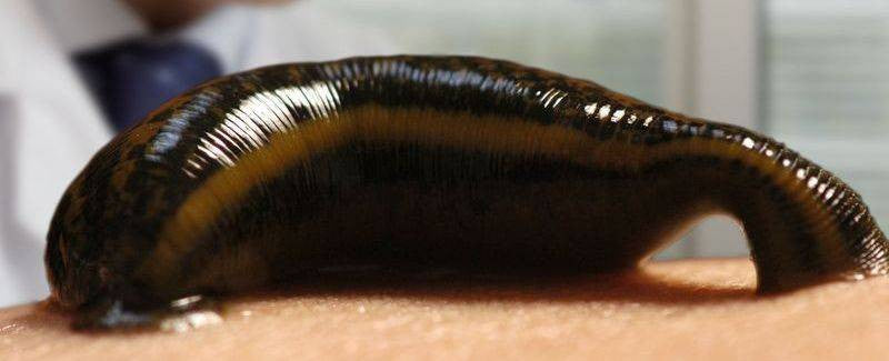 What Are Leeches?
