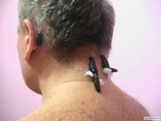 Leech Therapy for Cysts, Lumps, Skin Bumps, Tumors