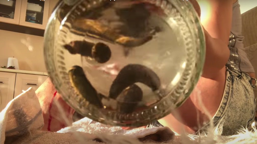 What happens after leech therapy? Tsetsi's Hirudotherapy aftermath. How to contain the bleeding?