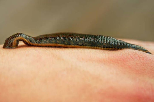 Leech therapy: help with osteoarthritis, back pain and high blood pressure