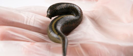 Which diseases will leeches help with - and how?