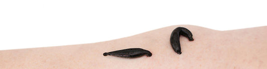 Natural healing in Switzerland: Leech Therapy