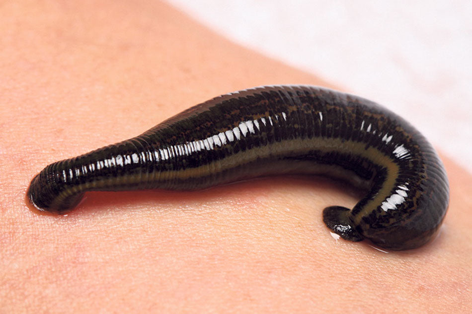 The Range of uses of Leech Therapy