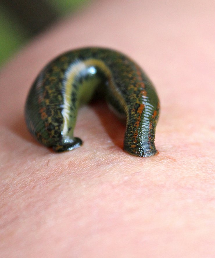 Leech therapy in medical practice