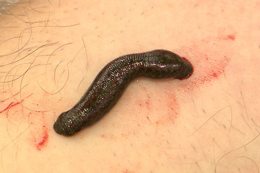 Leech Therapy in the Vienna Hospital