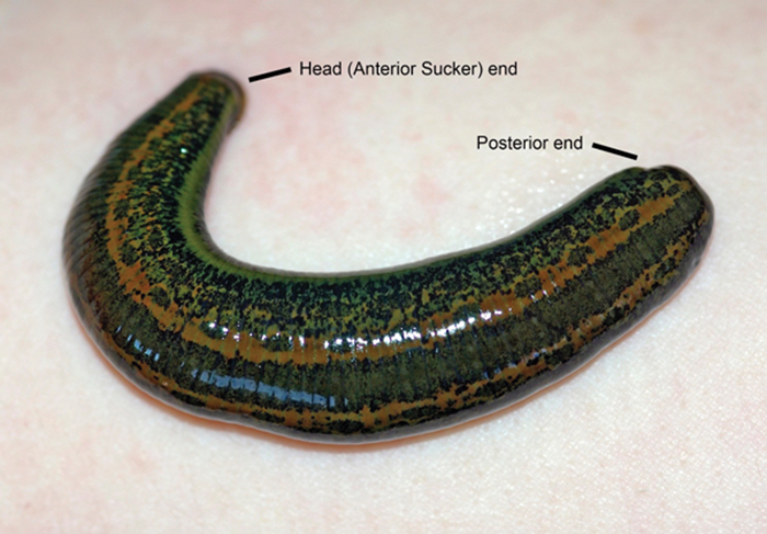 Leech Therapy