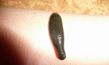 In Which Cases the Leeches not bite?